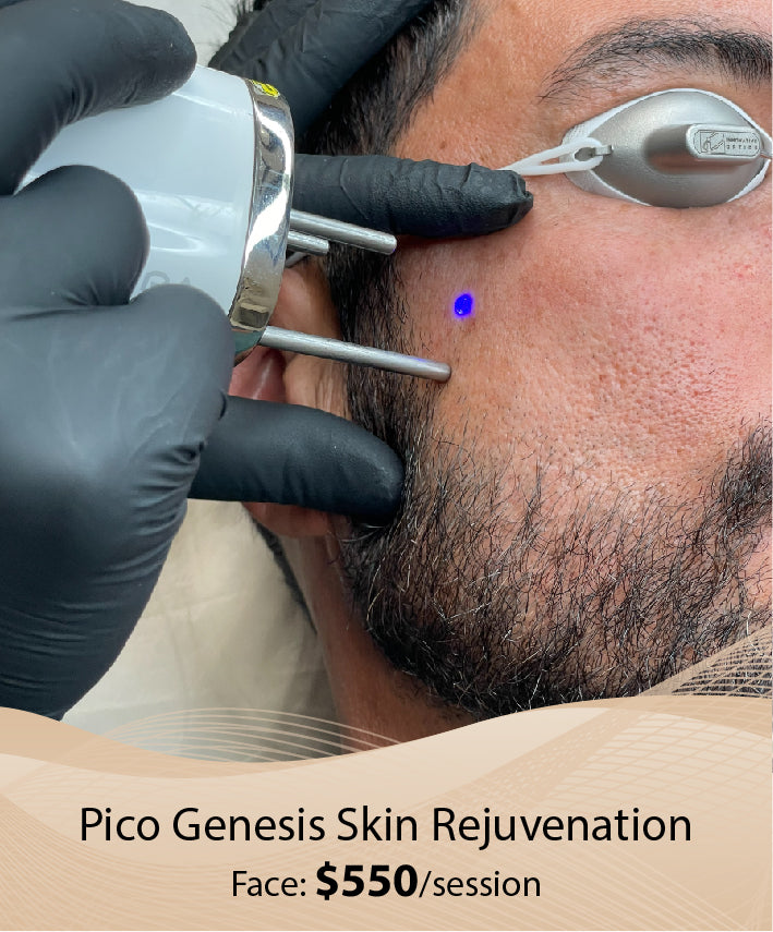 Pico Genesis Skin Rejuvenation (Face - Single Session)