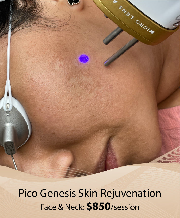 Pico Genesis Skin Rejuvenation (Face & Neck - Single Session)