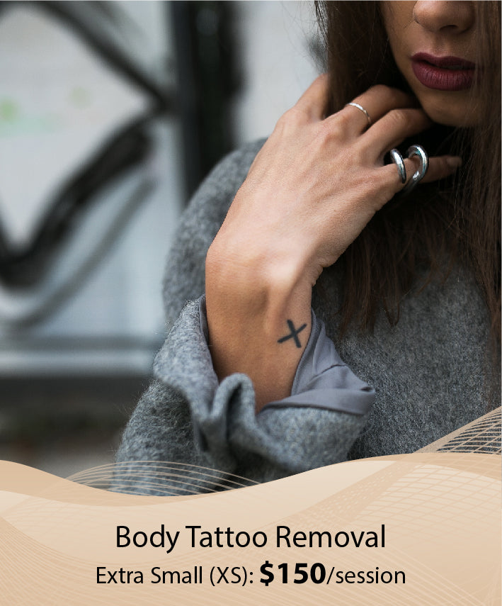 Body Tattoo Removal  (Extra Small (XS) - Single Session)