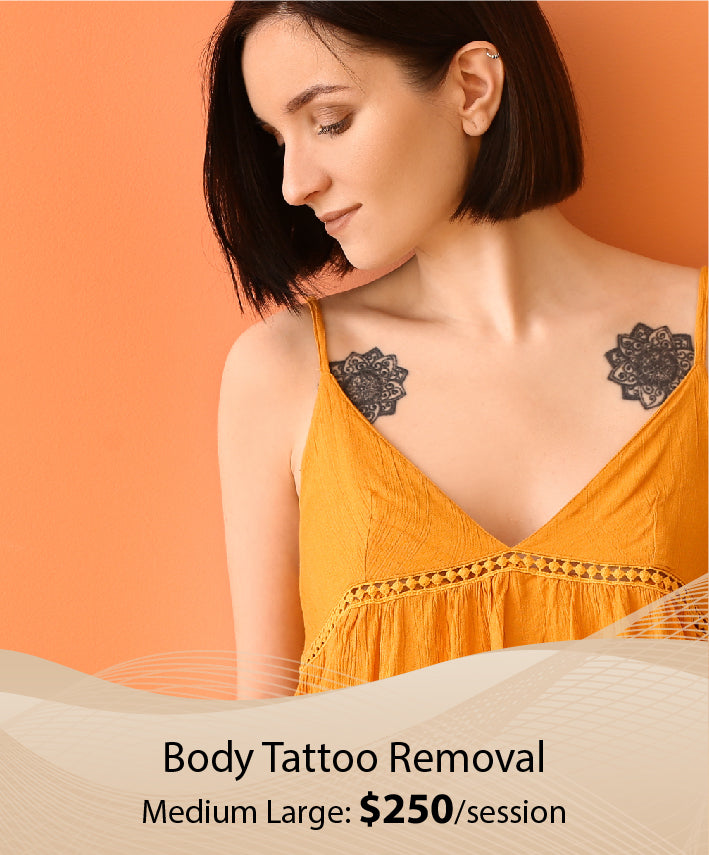 Body Tattoo Removal  (Medium Large - Single Session)