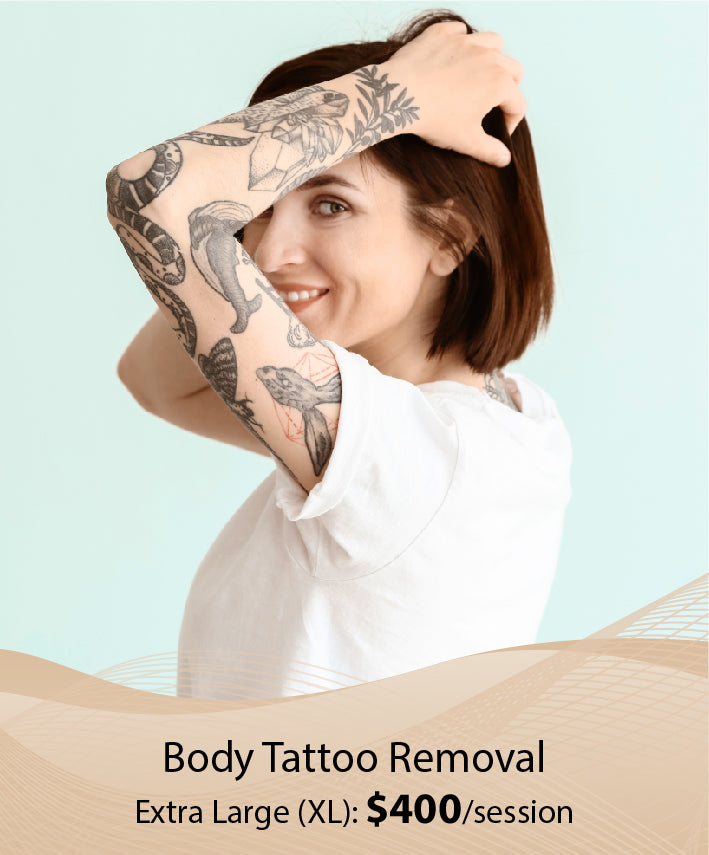 Body Tattoo Removal (Extra Large (XL) - Single Session)