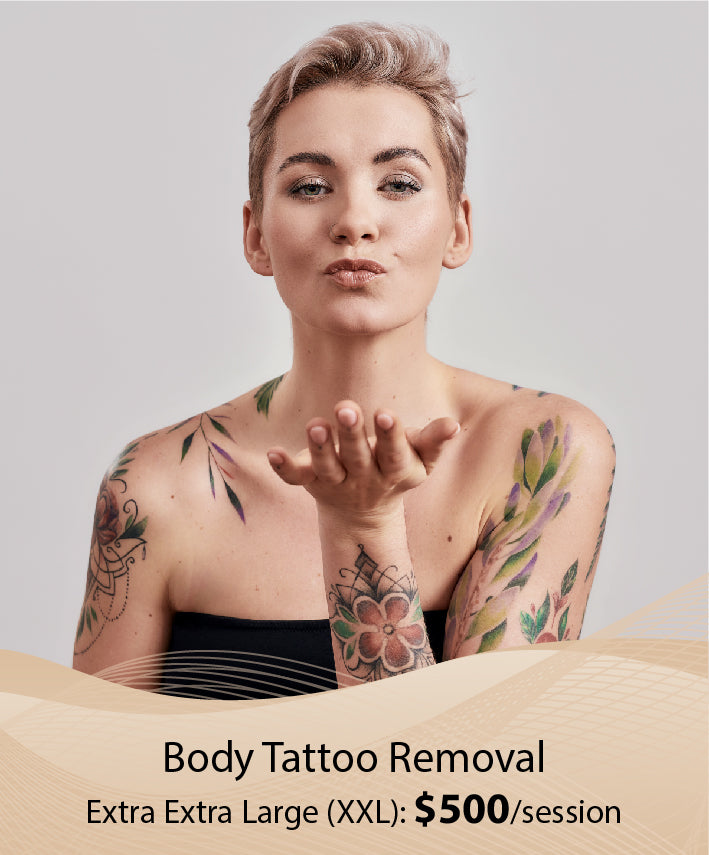 Body Tattoo Removal (Extra Extra Large (XXL) - Single Session)