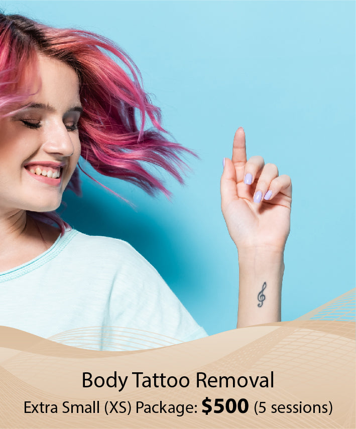 Body Tattoo Removal  (Extra Small (XS) Package - 5 Session)