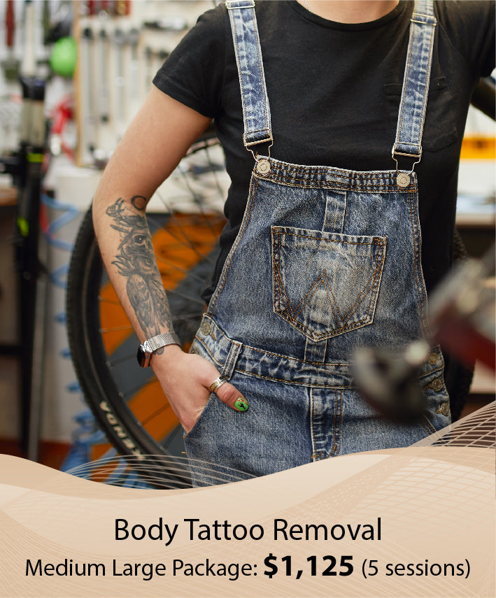 Body Tattoo Removal  (Medium Large Package - 5 Session)