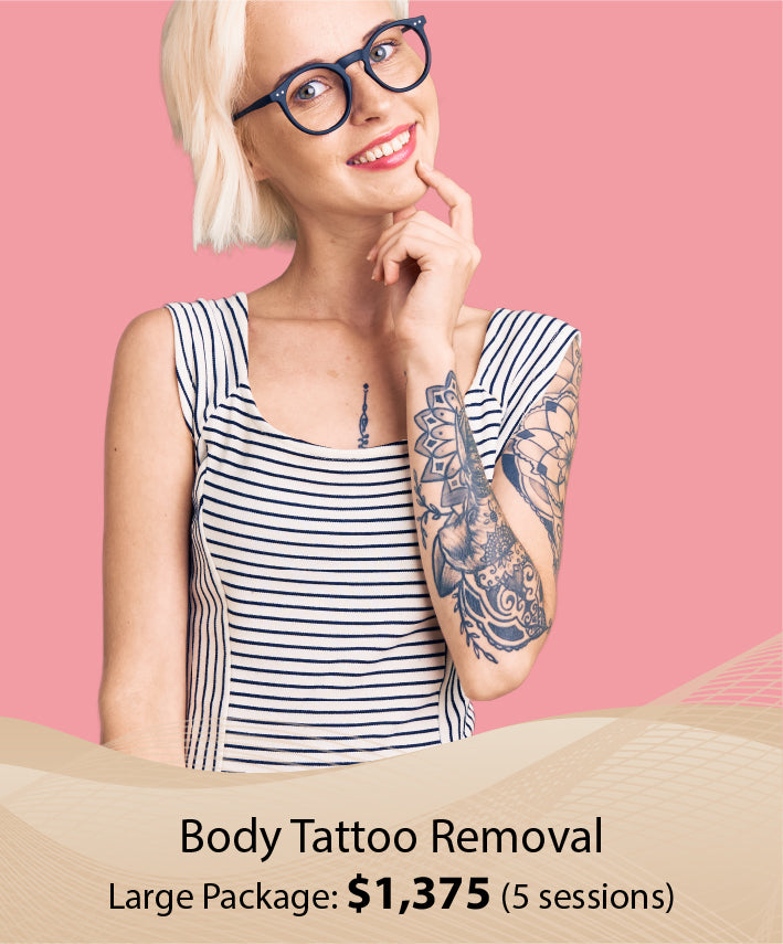 Body Tattoo Removal (Large Package - 5 Session)