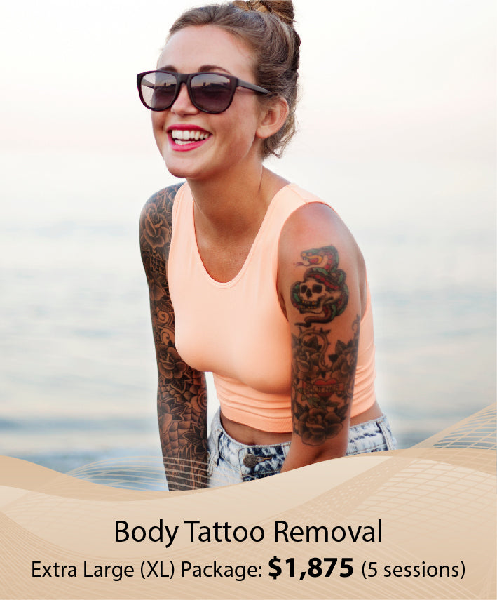 Body Tattoo Removal (Extra Large (XL) Packag - 5 Session)